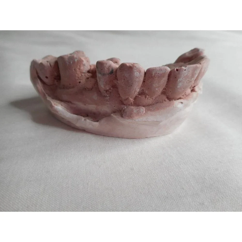 Vintage Cast Dental Teeth Mold Tooth Castings #11 - Picture 1 of 5